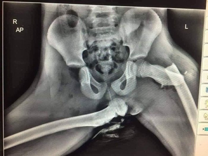 effet de l 'airbag.jpg