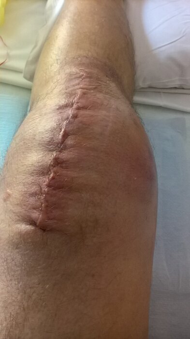 GG 1er juillet 2022.jpg